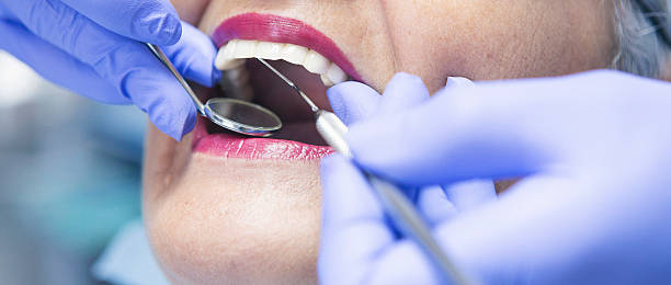 Best Same-Day Emergency Dental Services in Moweaqua, IL